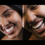 Sorrisos em cada detalhe, com lente de porcelana